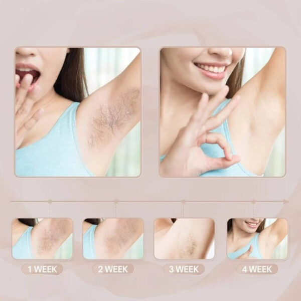 Femme utilisant l’épilateur IPL à domicile.